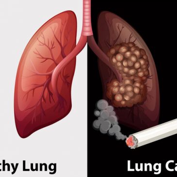 Những tỷ lệ giữa việc hút thuốc lá và ung thư phổi